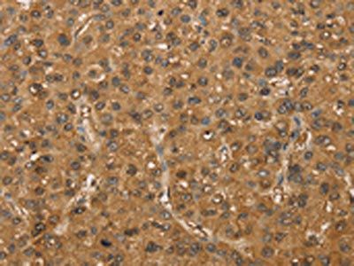 SETD2 Antibody