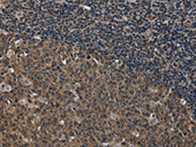 SETD7 Antibody