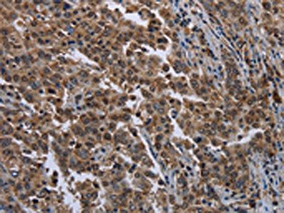 SETD7 Antibody