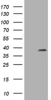 Sex Hormone Binding Globulin Antibody