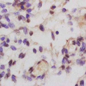 SHBG Rabbit Polyclonal Antibody