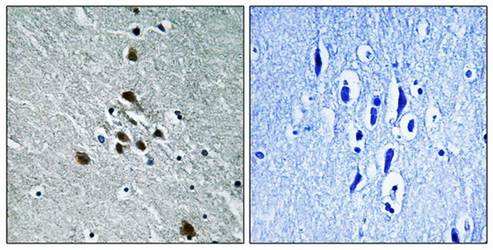 SF1 (Phospho-Ser82) Antibody