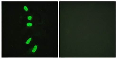 SF1 (Ab-82) Antibody