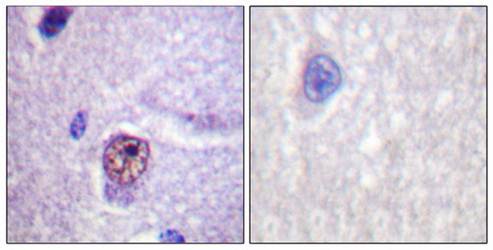SF1 (Ab-82) Antibody