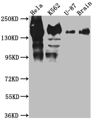 SF3B1 Recombinant Monoclonal Antibody