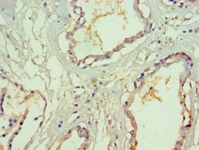 SF3B3 Antibody