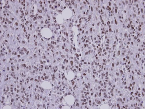 SAP130 antibody [C3], C-term