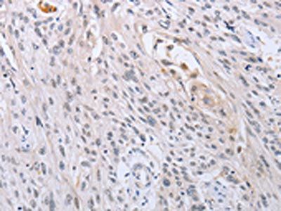 SFRP1 Antibody