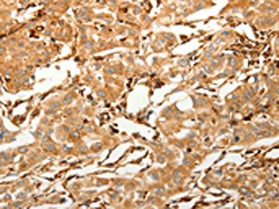 SFRP1 Antibody