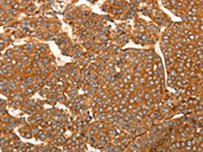 SFRP1 Antibody