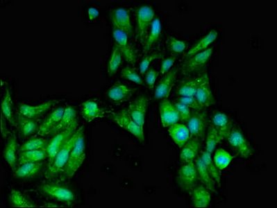 SFRP2 Antibody
