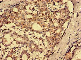 SFRP4 Antibody