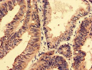 SFRP4 Antibody