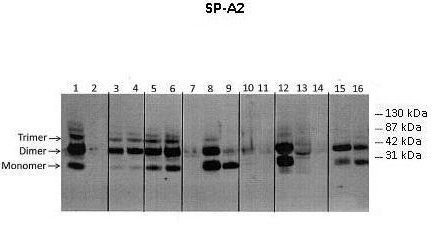 SFTPA2 antibody