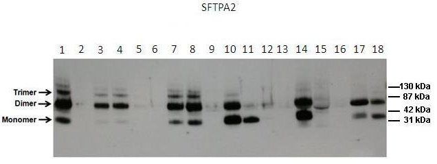SFTPA2 antibody