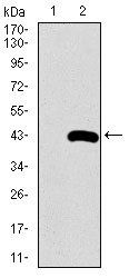 SFTPC Antibody