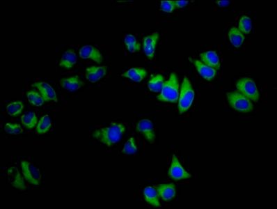 SGCB antibody