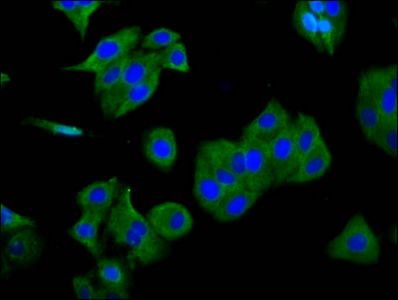 SGCG antibody