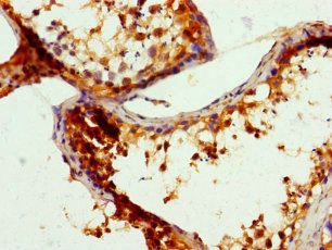 SGF29 Antibody