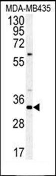 SGF29 antibody