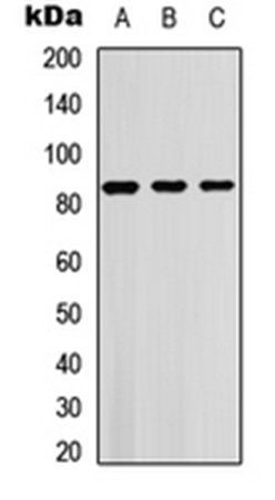 SGK1/2 (phospho-T256/253) antibody