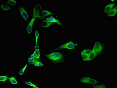 SGK1 Antibody