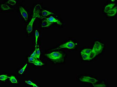 SGK1 antibody