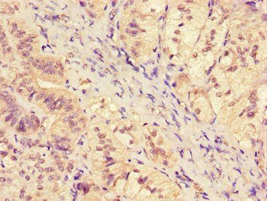 SGK1 Antibody
