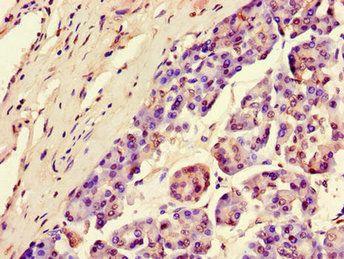 SGK1 Antibody