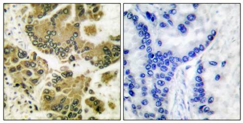 SGK (Ab-422) Antibody