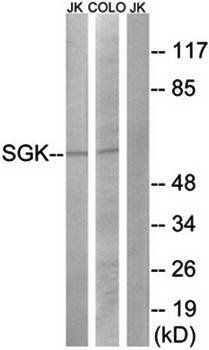 SGK (Ab-422) Antibody