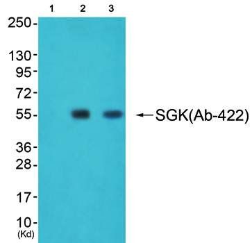 SGK (Ab-422) Antibody
