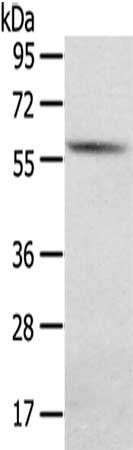 SGPL1 antibody