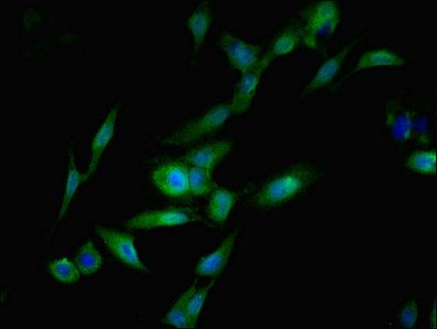 SGTA antibody