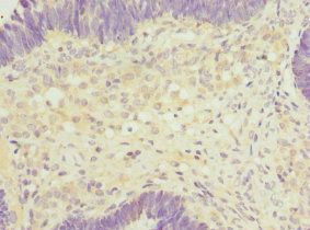 SH2B1 Antibody