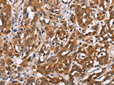 SH2B2 Antibody