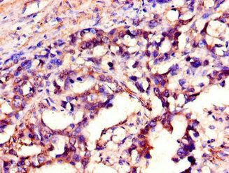 SH2D1A Antibody