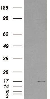 SH2D1A antibody