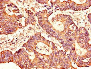 SH2D1B Antibody