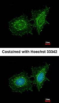 SH3 domain-binding protein 1 Rabbit Polyclonal Antibody