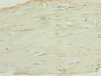 SH3BGRL3 Antibody