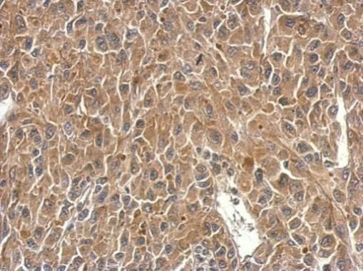 SH3BP1 antibody