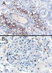 Goat anti-SH3BP1 Antibody