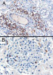 SH3BP1 antibody