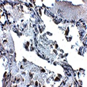 SH3BP4 Antibody