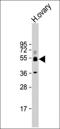 SH3BP5 antibody