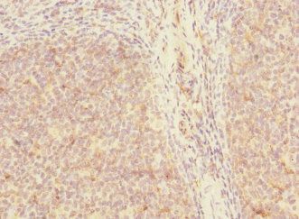 SH3D19 Antibody