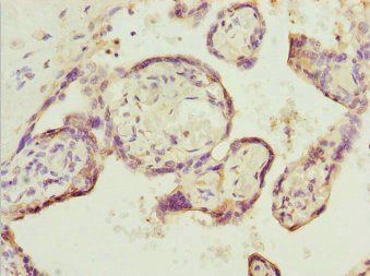 SH3GL1 Antibody