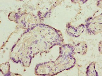 SH3GL1 Antibody