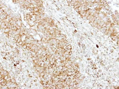 SH3GL1 antibody [N3C3]